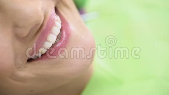 牙齿病人满意治疗漂白的美丽雪白笑容视频的预览图