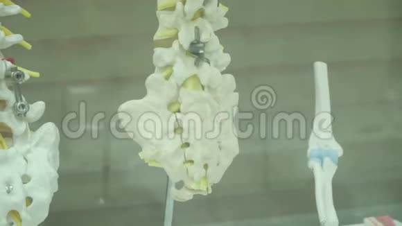 金属假肢人体脊柱修复实例视频的预览图