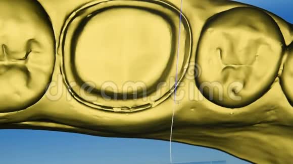 石膏义齿三维扫描视频的预览图