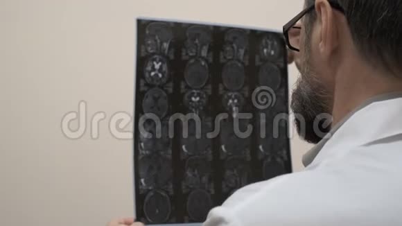 医生检查病人脑部核磁共振视频的预览图