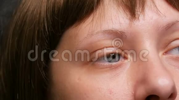 化疗后蓝眼睛的年轻女性患癌症的脸最近长出的眉毛和睫毛视频的预览图