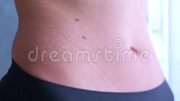 女人的皮肤剥落从紫外线晒伤腹部特写视频的预览图
