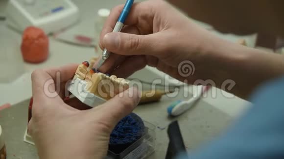 牙医做了一个牙模视频的预览图