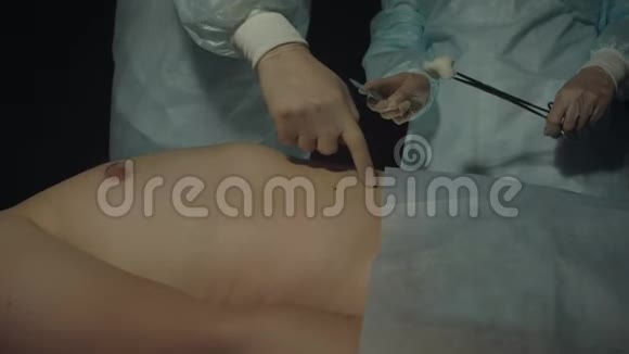 外科医生告诉助手在手术或手术过程中在病人的身体上做切口人的谎言视频的预览图