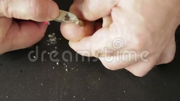 男性手工具用真菌切断真菌脚趾甲视频的预览图
