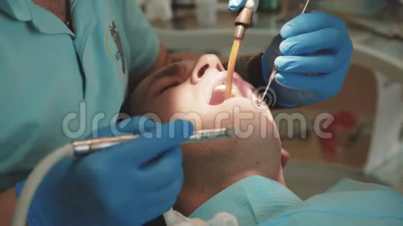 牙科医生在诊所用牙钻治疗病人牙齿4K视频的预览图