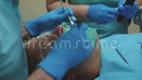 牙科医生在临床上用牙钻治疗病人牙齿4K视频的预览图