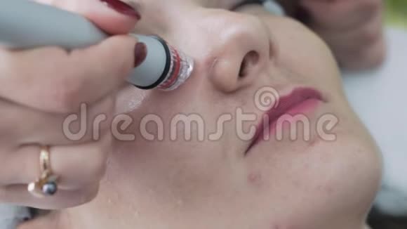 美容诊所面部水剥离术中女性面部特写慢动作视频的预览图