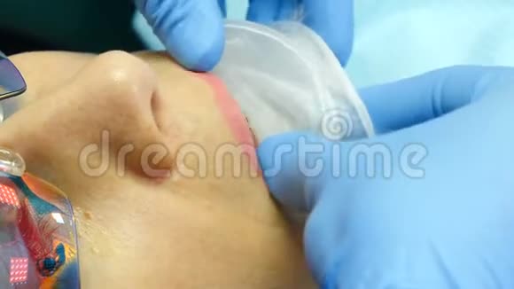 牙齿治疗手套上的女牙医助手特写镜头安装无菌扩口器视频的预览图