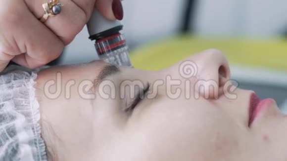 特写美容医生用水剥离装置在病人脸上做手术动作缓慢视频的预览图