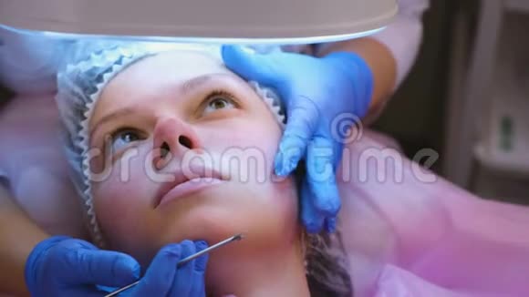 美容师的面部机械清洁美容医生把痤疮挤在病人的下巴上视频的预览图