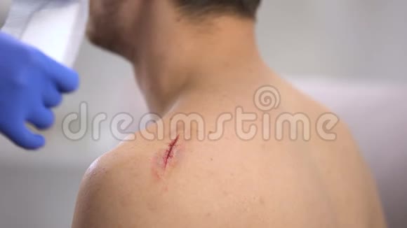 医生双手用胶布包扎男性患者肩伤视频的预览图