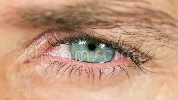 近距离慢动作镜头人蓝眼睛移动眼球和眨眼产生相当令人痛苦的效果视频的预览图
