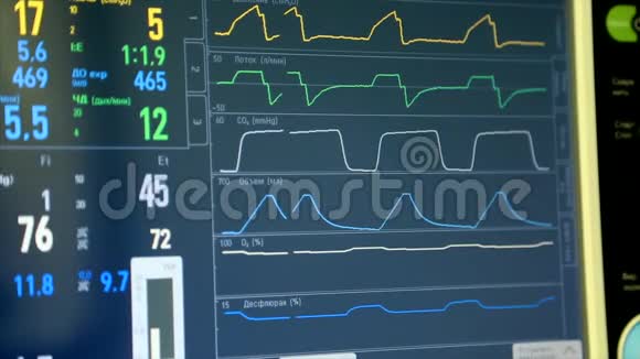 住院ICU监护仪上患者状况生命体征的监测重症监护室医疗监护仪与患者至关重要视频的预览图