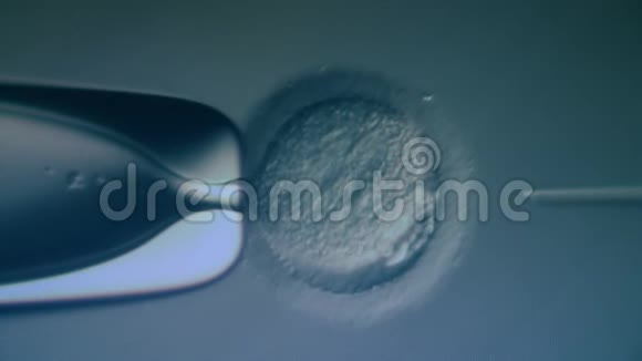 试管婴儿体外受精过程卵细胞的放大人工受精视频的预览图
