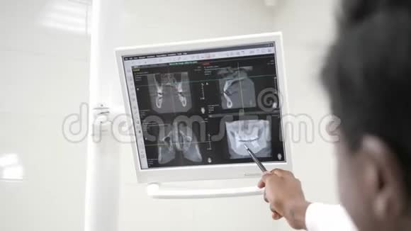 年轻的非裔美国男医生牙医体贴地看着显示器x光医学卫生口腔科视频的预览图
