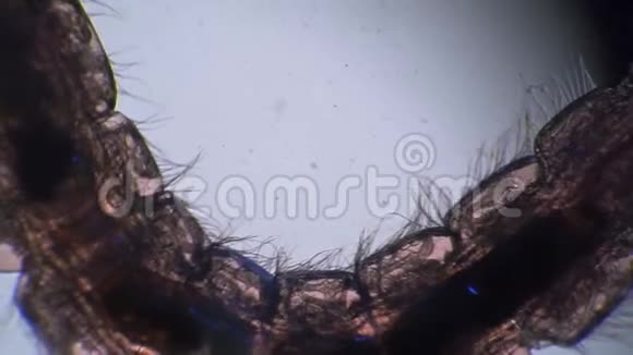 一只蚊子幼虫的头在显微镜下有两根刺视频的预览图