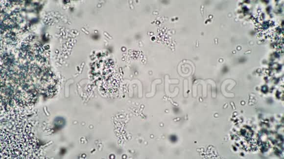 显微镜下乳杆菌在酵中漂浮视频的预览图