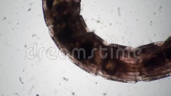 在显微镜下水蚤和蚊子幼虫是相邻的视频的预览图