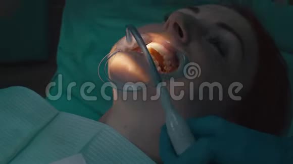 安装等压线固定牙齿牙齿美白手术视频的预览图
