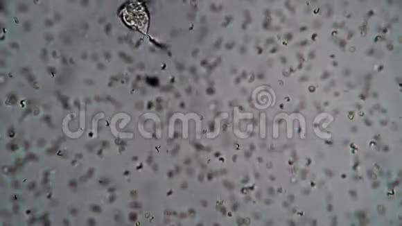 显微镜下观察纤毛虫视频的预览图