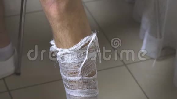 一个人用绷带包扎他的腿视频的预览图