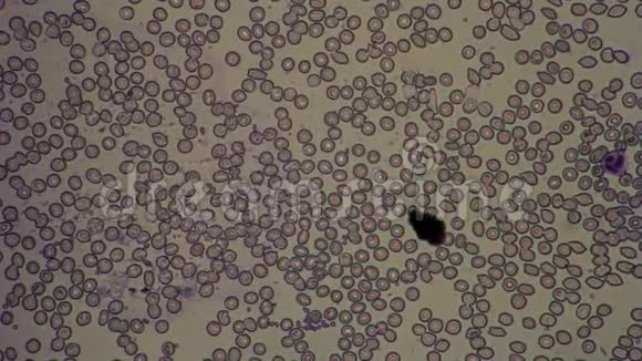 显微镜下检测人血红细胞视频的预览图