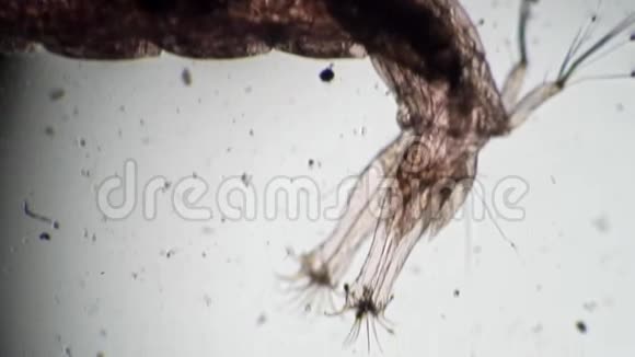 显微镜下有可见虫体的透明体视频的预览图