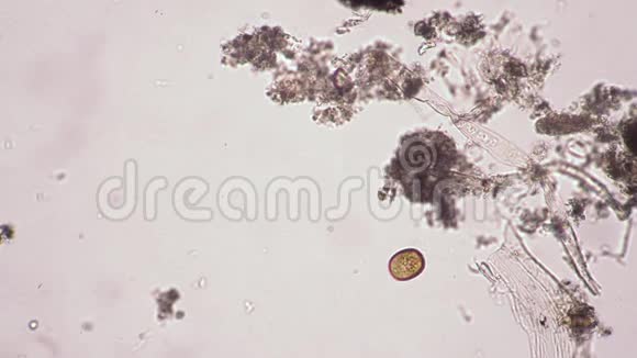 infusoria在显微镜下漂浮在河水中视频的预览图