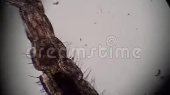科的针体在显微镜下的脏水特写中移动视频的预览图