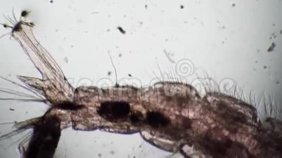 显微镜下蠕虫微生物的排便视频的预览图