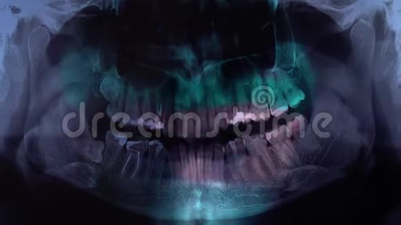 医生在x光片上显示牙齿牙医一边看一边拿着x光片牙医看牙特写视频的预览图