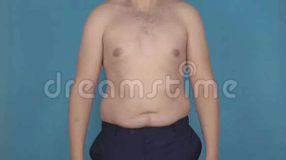 一个腹部赤裸的年轻人跳起来摇动脂肪褶皱和腹部脂肪团营养不良的概念视频的预览图