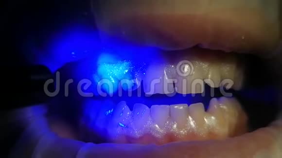 蓝色紫外线灯液体光聚合物材料发光液坝视频的预览图
