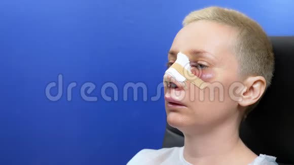 隆鼻后第二天特写女性面部绷带视频的预览图