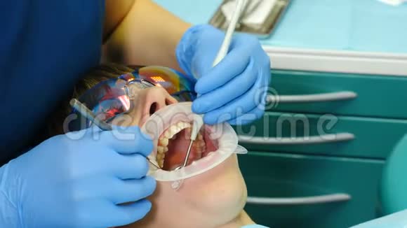 在现代牙医办公室牙科手术的特写镜头女性患者接受牙齿治疗牙医使用工具视频的预览图