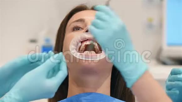 牙医检查病人与Braces视频的预览图