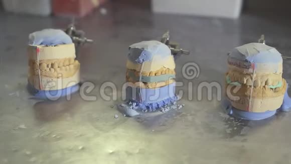 石膏模型上的陶瓷冠视频的预览图