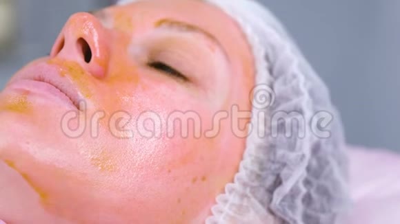化学剥皮女人脸清洁面部皮肤减轻雀斑皮肤特写的脸视频的预览图