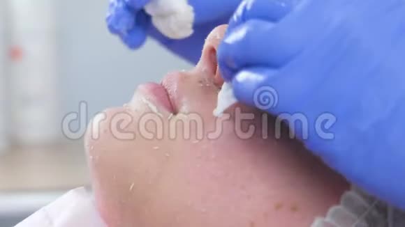 美容师将面膜卷在女人面部按摩动作上美容师面部治疗特写镜头视频的预览图