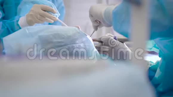 在牙科诊所做了严重的手术外科医生给病人植入假牙完美风格的条件是视频的预览图