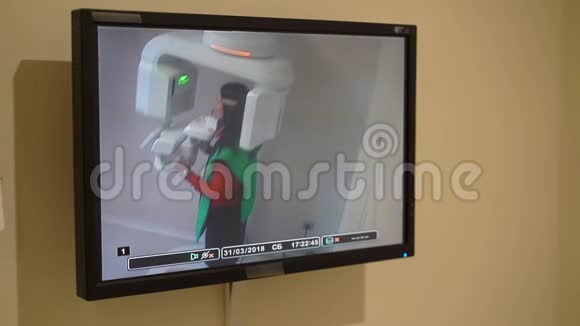 病人的X线断层扫描视频的预览图
