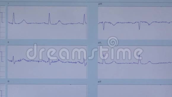 医用心脏监护仪测量心电上机检查检查心率视频的预览图