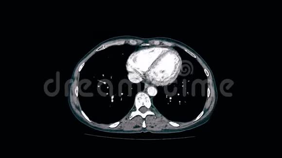 腹腔胃肠道膀胱的彩色对比MRI视频的预览图