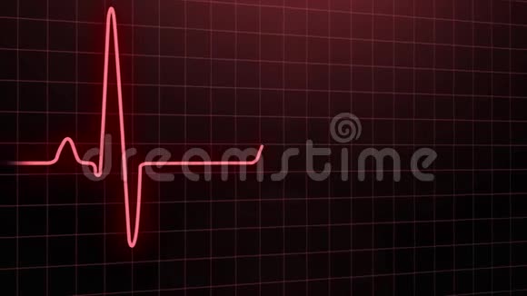 心跳脉搏呈红色视频的预览图