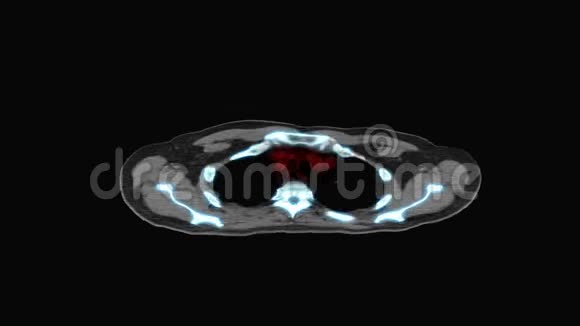 人体MRI扫描视频的预览图