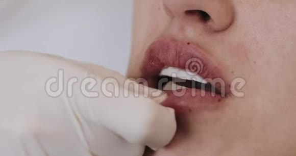 脂肪增强关闭医生美容师为一位美女做了隆唇手术视频的预览图
