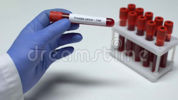 前列腺癌医生在试管中显示血样实验室研究健康检查视频的预览图