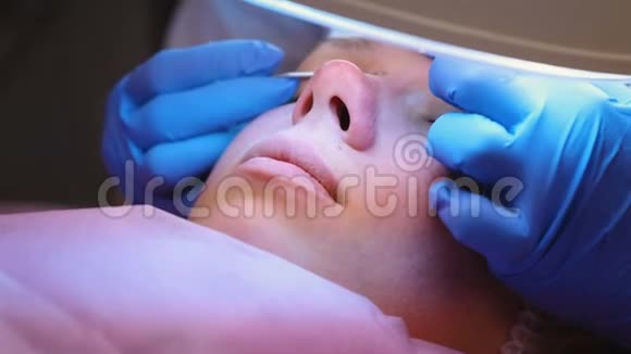 美容师的面部清洁用针头和放大镜挤压鼻子上的粉刺特写的脸视频的预览图