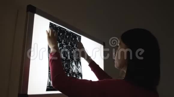 女性外科医生在光监测仪上查看roentgen结果视频的预览图